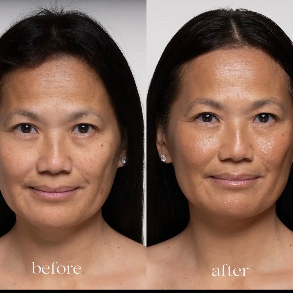Epiclight‎ Luminizing glow gel BNIB - Picture 8 of 11